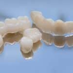 Transform Your Smile with Dental Crowns: Expert Tips and Insights_FI
